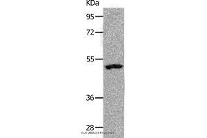 Western blot analysis of Human lymphoma tissue, using NDRG1 Polyclonal Antibody at dilution of 1:1000 (NDRG1 anticorps)
