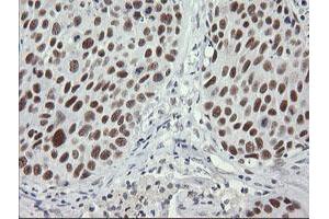 Image no. 8 for anti-SEC14 and Spectrin Domains 1 (SESTD1) antibody (ABIN1501066) (SESTD1 anticorps)