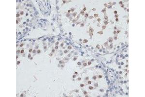 Immunohistochemistry of paraffin-embedded Rat testis using NOL3 Polyclonal Antibody at dilution of 1:100 (40x lens).