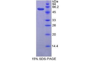 SDS-PAGE (SDS) image for Granzyme D (GZMD) (AA 33-245) protein (His tag,GST tag) (ABIN2122933)