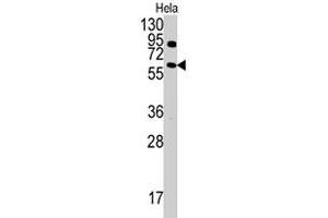 Western blot analysis of ANTXR1 polyclonal antibody  in HeLa cell line lysates (35 ug/lane). (ANTXR1 anticorps  (Tyr382))