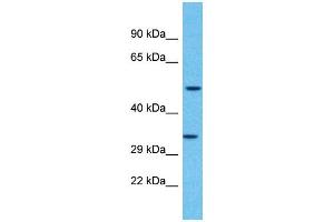 Western Blotting (WB) image for anti-Olfactory Receptor, Family 2, Subfamily F, Member 2 (OR2F2) (C-Term) antibody (ABIN2791722) (OR2F2 anticorps  (C-Term))