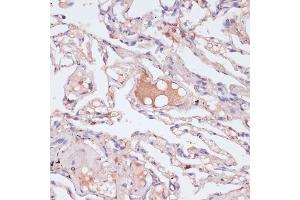 Immunohistochemistry of paraffin-embedded human lung using IFNG antibody (ABIN6128080, ABIN6142195, ABIN6142196 and ABIN6216082) at dilution of 1:100 (40x lens). (Interferon gamma anticorps  (AA 24-166))