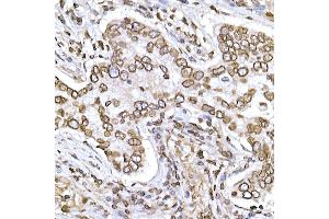 Immunohistochemistry of paraffin-embedded human tonsil using CD38 Rabbit pAb (ABIN3015544, ABIN3015545, ABIN1679089 and ABIN6218776) at dilution of 1:150 (40x lens).