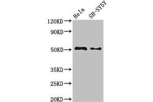 Western Blot Positive WB detected in: Hela whole cell lysate, SH-SY5Y whole cell lysate All lanes: FADS1 antibody at 3. (FADS1 anticorps  (AA 1-121))
