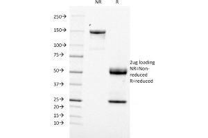 SDS-PAGE Analysis Purified CD21 / CR2 Mouse Monoclonal Antibody (CR2/1953). (CD21 anticorps  (AA 44-196))