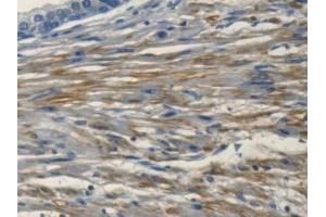 Detection of PSMC4 in Human Prostate Tissue using Polyclonal Antibody to Proteasome 26S Subunit, ATPase 4 (PSMC4)