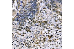 IHC analysis of BUB1 using anti-BUB1 antibody (ABIN7600942). (BUB1 anticorps  (AA 26-1085))