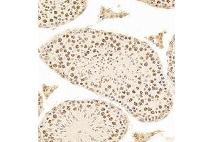 Immunohistochemistry of paraffin embedded mouse testis using DNApoldelta3 (ABIN7075130) at dilution of 1:650 (300x lens)