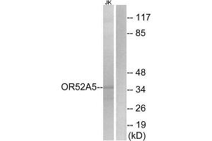 Western Blotting (WB) image for anti-Olfactory Receptor 52A5 (OR52A5) (Internal Region) antibody (ABIN1853402) (OR52A5 anticorps  (Internal Region))
