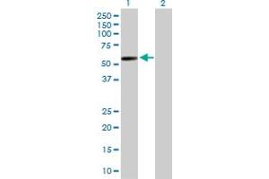 Western Blot analysis of GAL3ST4 expression in transfected 293T cell line by GAL3ST4 MaxPab polyclonal antibody. (GAL3ST4 anticorps  (AA 1-486))