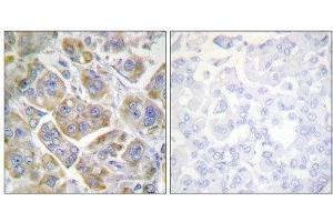 Immunohistochemistry (IHC) image for anti-Integrin beta 4 (ITGB4) (Tyr1510) antibody (ABIN1848054)