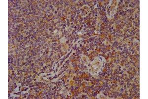 IHC image of ABIN7152326 diluted at 1:600 and staining in paraffin-embedded human lymph node tissue performed on a Leica BondTM system.