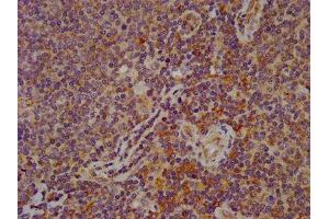 IHC image of ABIN7152326 diluted at 1:600 and staining in paraffin-embedded human lymph node tissue performed on a Leica BondTM system. (FAM62B anticorps  (AA 567-736))