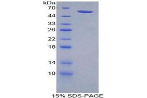 SDS-PAGE (SDS) image for Neuropilin 2 (NRP2) (AA 652-858) protein (His tag,GST tag) (ABIN2123390)
