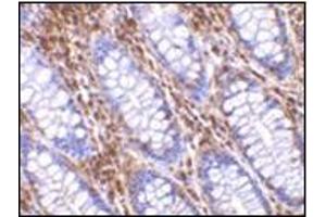 Immunohistochemistry of OMI in human colon tissue with this product at 10 μg/ml. (HTRA2 anticorps  (C-Term))
