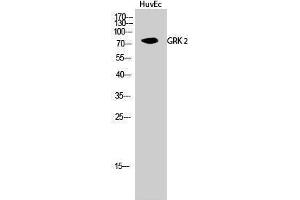 Western Blotting (WB) image for anti-Adrenergic, Beta, Receptor Kinase 1 (ADRBK1) (Ser129) antibody (ABIN3175424) (GRK2 anticorps  (Ser129))