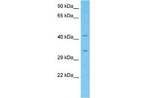 Host:  Rabbit  Target Name:  CAMLG  Sample Type:  Fetal Liver lysates  Antibody Dilution:  1. (CAMLG anticorps  (C-Term))