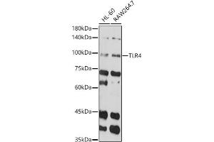 Western blot analysis of extracts of various cell lines, using TLR4 antibody (ABIN6134489, ABIN6149223, ABIN6149226 and ABIN6220893) at 1:1000 dilution.