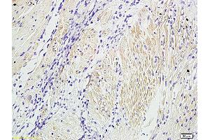 Formalin-fixed and paraffin embedded dog bladder labeled with Anti-Alpha-SMA Polyclonal Antibody, Unconjugated (ABIN726050) at 1:300 followed by conjugation to the secondary antibody and DAB staining