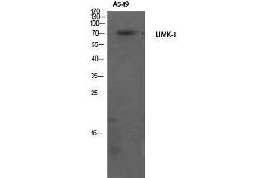 Western Blotting (WB) image for anti-LIM Domain Kinase 1 (LIMK1) (Internal Region) antibody (ABIN3185384) (LIM Domain Kinase 1 anticorps  (Internal Region))