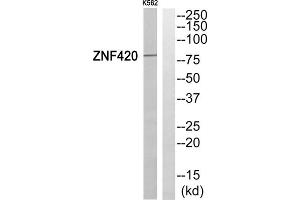 Western blot analysis of extracts from K562 cells, using ZNF420 antibody. (ZNF420 anticorps  (Internal Region))