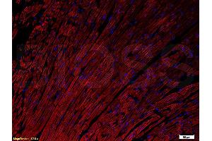 Formalin-fixed and paraffin embedded rat heart tissue labeled with Anti- Connexin-37 GJA4 Polyclonal Antibody, unconjugated (ABIN753343) at 1:200 followed by incubation with conjugated secondary antibody (Goat Anti-Rabbit IgG, PE conjugated (ABIN727474-PE) used at 1:200 dilution for 40 minutes at 37C and DAPI.