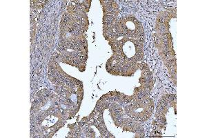 IHC analysis of FEN1 using anti-FEN1 antibody (ABIN7601619). (FEN1 anticorps  (AA 4-300))