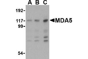 Western blot analysis of MDA5 in Daudi cell lysate with MDA5 antibody at (A) 1, (B) 2 and (C) 4 µg/mL. (IFIH1 anticorps  (Middle Region))