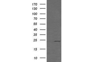 Image no. 3 for anti-RAB21, Member RAS Oncogene Family (RAB21) antibody (ABIN1500541)