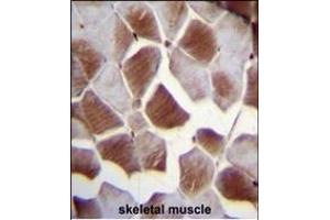 EIF2B4 Antibody (Center ) (ABIN655170 and ABIN2844788) immunohistochemistry analysis in formalin fixed and paraffin embedded human skeletal muscle followed by peroxidase conjugation of the secondary antibody and DAB staining.