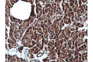 Image no. 5 for anti-Phosphatidylinositol-4-Phosphate 3-Kinase, Catalytic Subunit Type 2 beta (PIK3C2B) antibody (ABIN1500199)