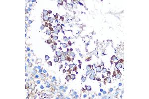 Immunohistochemistry of paraffin-embedded rat testis using WISP2 Rabbit pAb (ABIN6128929, ABIN6150227, ABIN6150229 and ABIN6223338) at dilution of 1:100 (40x lens). (WISP2 anticorps  (AA 1-250))