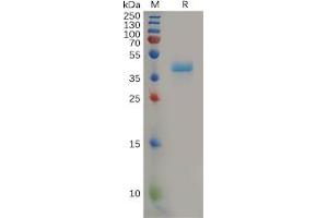 Human CCR8 Protein, hFc Tag on SDS-PAGE under reducing condition. (CCR8 Protein (Fc Tag))