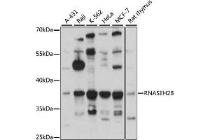Western blot analysis of extracts of various cell lines, using RNB antibody (ABIN6133304, ABIN6146990, ABIN6146991 and ABIN6220814) at 1:3000 dilution.