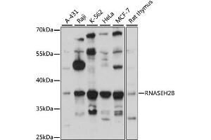 Western blot analysis of extracts of various cell lines, using RNB antibody (ABIN6133304, ABIN6146990, ABIN6146991 and ABIN6220814) at 1:3000 dilution. (RNASEH2B anticorps  (AA 1-290))