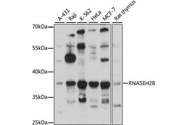 RNASEH2B anticorps  (AA 1-290)