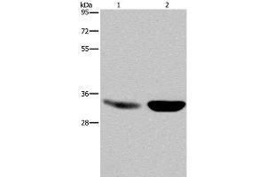 Western Blot analysis of Human fetal brain and Mouse brain tissue using MAPRE3 Polyclonal Antibody at dilution of 1:500 (MAPRE3 anticorps)