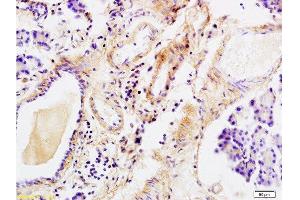 Formalin-fixed and paraffin embedded rat pancreas tissue labeled with Anti-Tenascin C/Tn-C Polyclonal Antibody, Unconjugated  at 1:200 followed by conjugation to the secondary antibody and DAB staining
