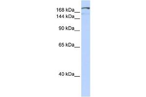 WB Suggested Anti-NFAT5 Antibody Titration:  0. (NFAT5 anticorps  (Middle Region))