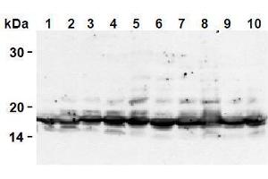 Western Blotting (WB) image for anti-Histone H2A antibody (ABIN1107544)