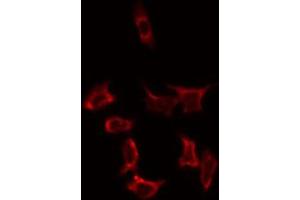 ABIN6274814 staining HeLa by IF/ICC. (SLC25A31 anticorps  (Internal Region))