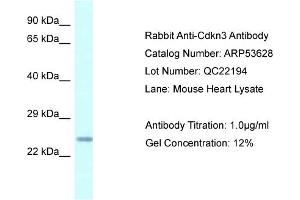Western Blotting (WB) image for anti-Cyclin-Dependent Kinase Inhibitor 3 (CDKN3) (N-Term) antibody (ABIN970374) (CDKN3 anticorps  (N-Term))