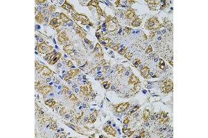 Immunohistochemistry of paraffin-embedded human stomach using GM13125 antibody (ABIN6127294, ABIN6141172, ABIN6141175 and ABIN6216319) at dilution of 1:100 (40x lens). (Pramel15 anticorps  (AA 1-477))