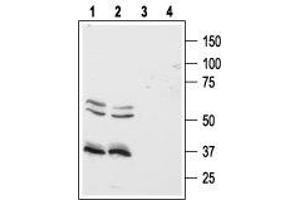 Western blot analysis of human Colo-205 (lanes 1 and 3) and  (lanes 2 and 4) colon cancer cell lines:1,2. (Hypocretin (Orexin) Receptor 1 (HCRTR1) Peptide)