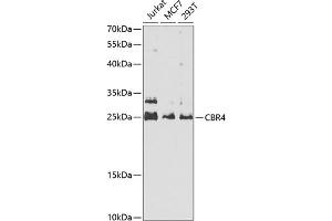 Western blot analysis of extracts of various cell lines, using CBR4 antibody  at 1:1000 dilution.