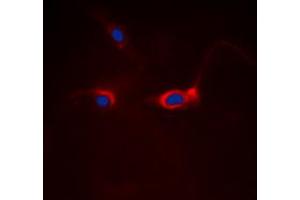 Immunofluorescent analysis of FOXO1 staining in Hela cells.