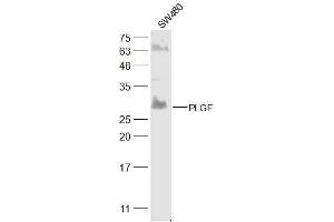 SW480 lysates probed with PLGF Polyclonal Antibody, Unconjugated  at 1:300 dilution and 4˚C overnight incubation. (PLGF anticorps  (AA 166-221))