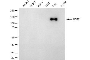 Western blotting analysis using CD22 antibody (ABIN7797960).