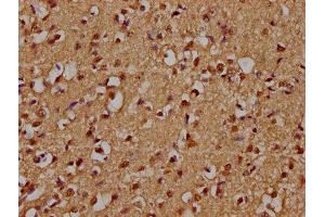 IHC image of ABIN7176307 diluted at 1:300 and staining in paraffin-embedded human brain tissue performed on a Leica BondTM system. (ZFP42 anticorps  (AA 50-256))